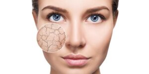 zoom_circle_shows_facial_skin_before_moistening_1024x400